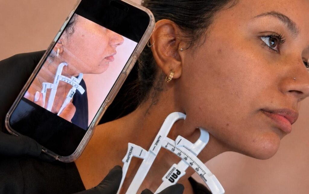 Avaliação da papada para lipo enzimática na Clínica Dra. Telma Lots em Atibaia